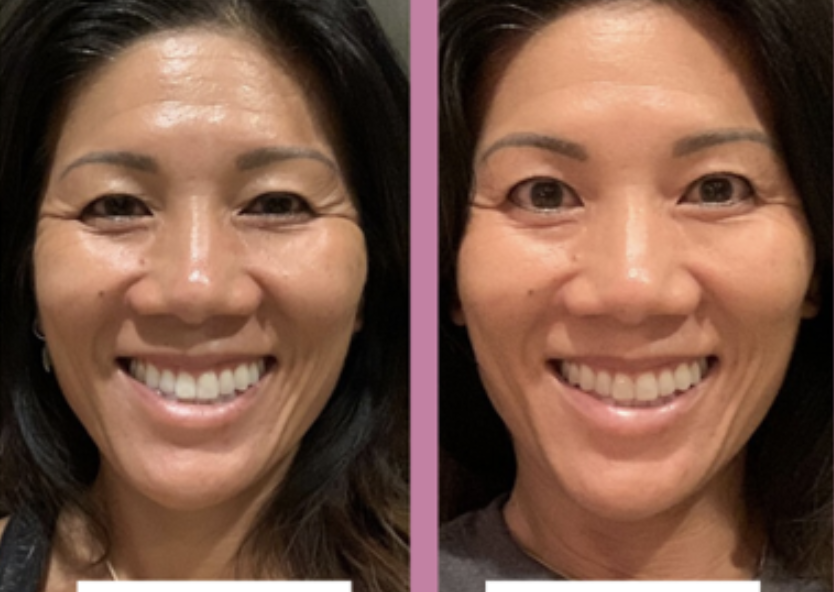 Captura de pantalla 2023-09-17 a la(s) 13.16.41